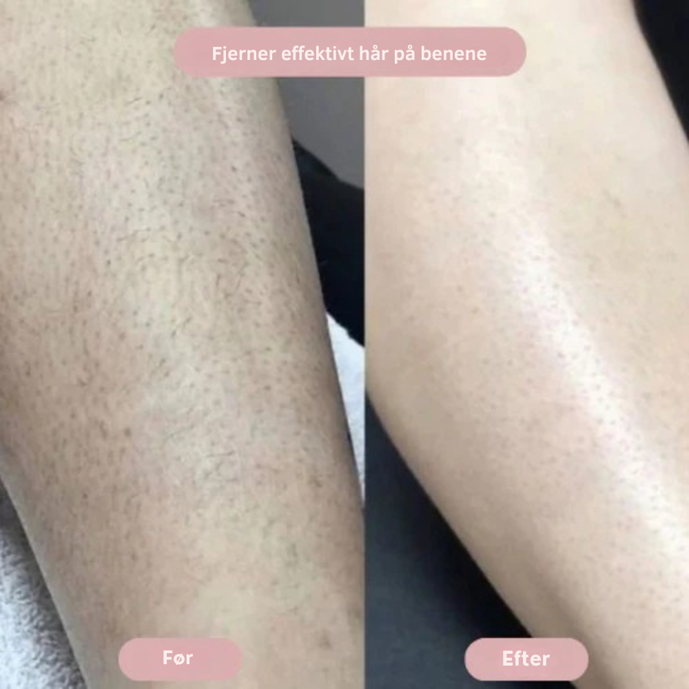 Silkyskin - Intimbarbering uden irritation