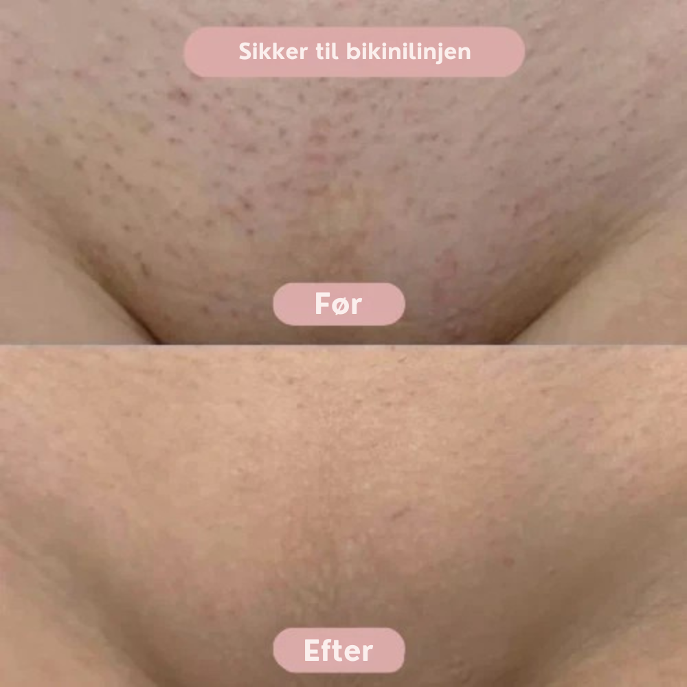Silkyskin - Intimbarbering uden irritation